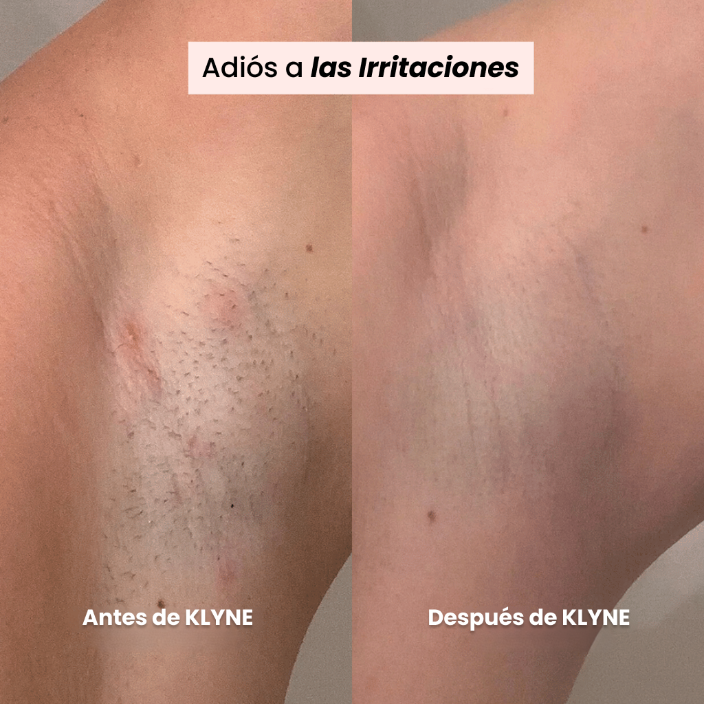 Afeitadora KLYNE®